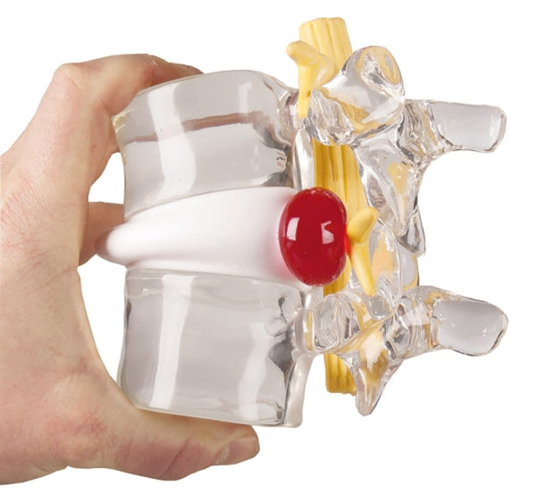 Innovativ og robust simulator af diskusprolaps