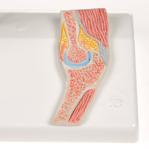 Formindsket albue m. sagittalsnit af leddet - eAnatomi