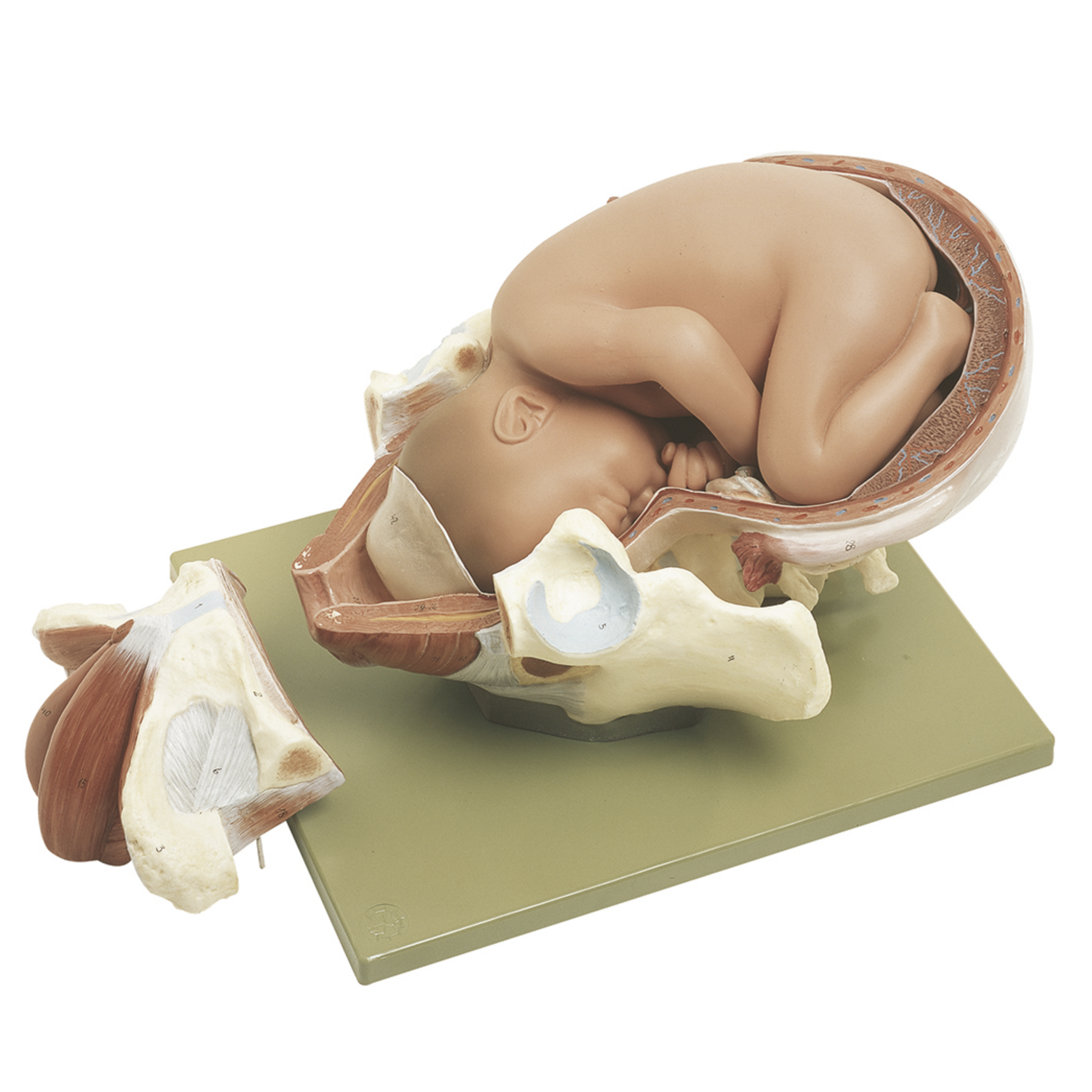 Birth in stage 1, the dilation phase