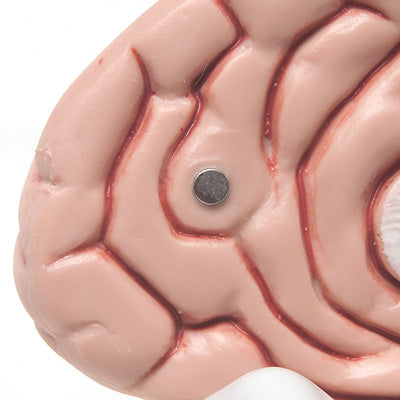 Brain in skull, 5 parts