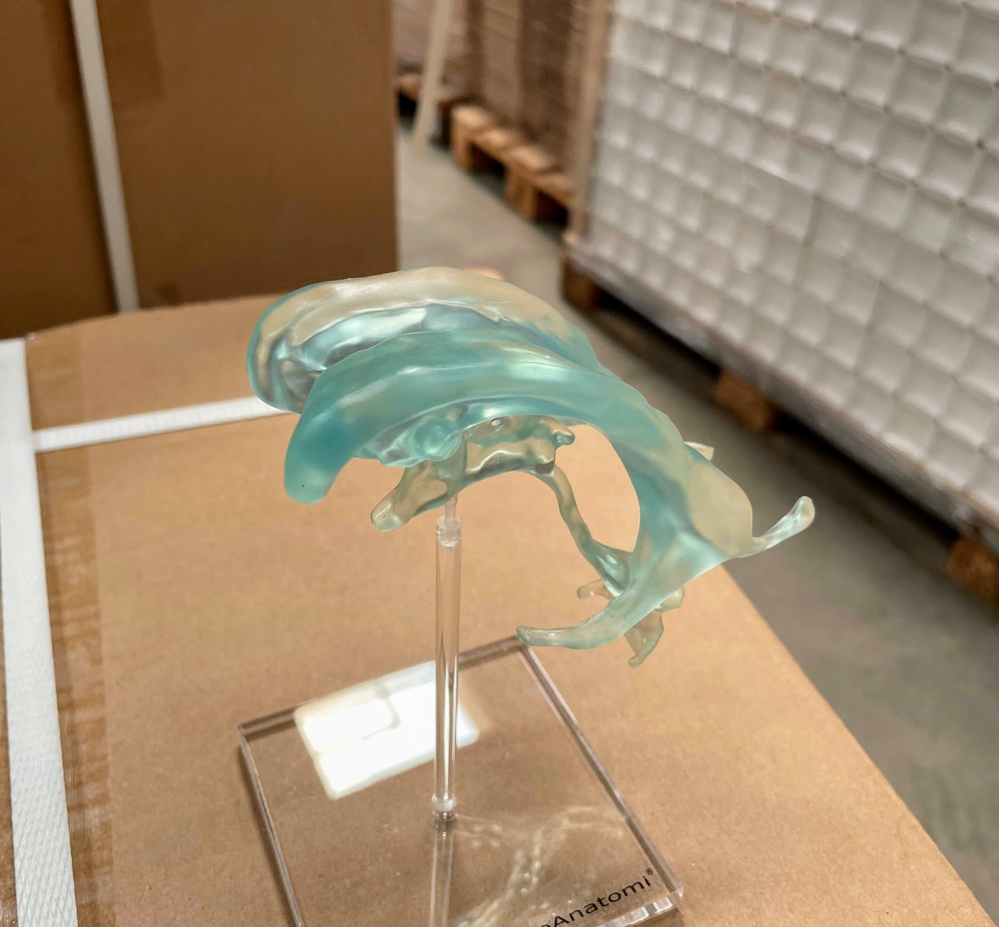 Model af hjernens ventrikler på stander af plexiglas - eAnatomi