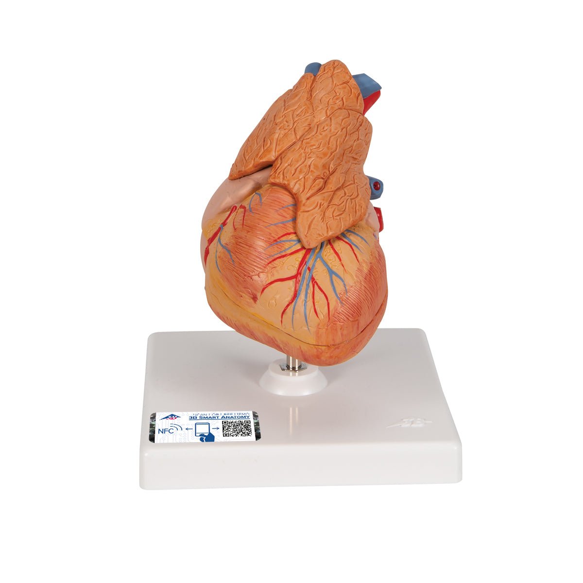 Formindsket hjerte m. thymus - eAnatomi