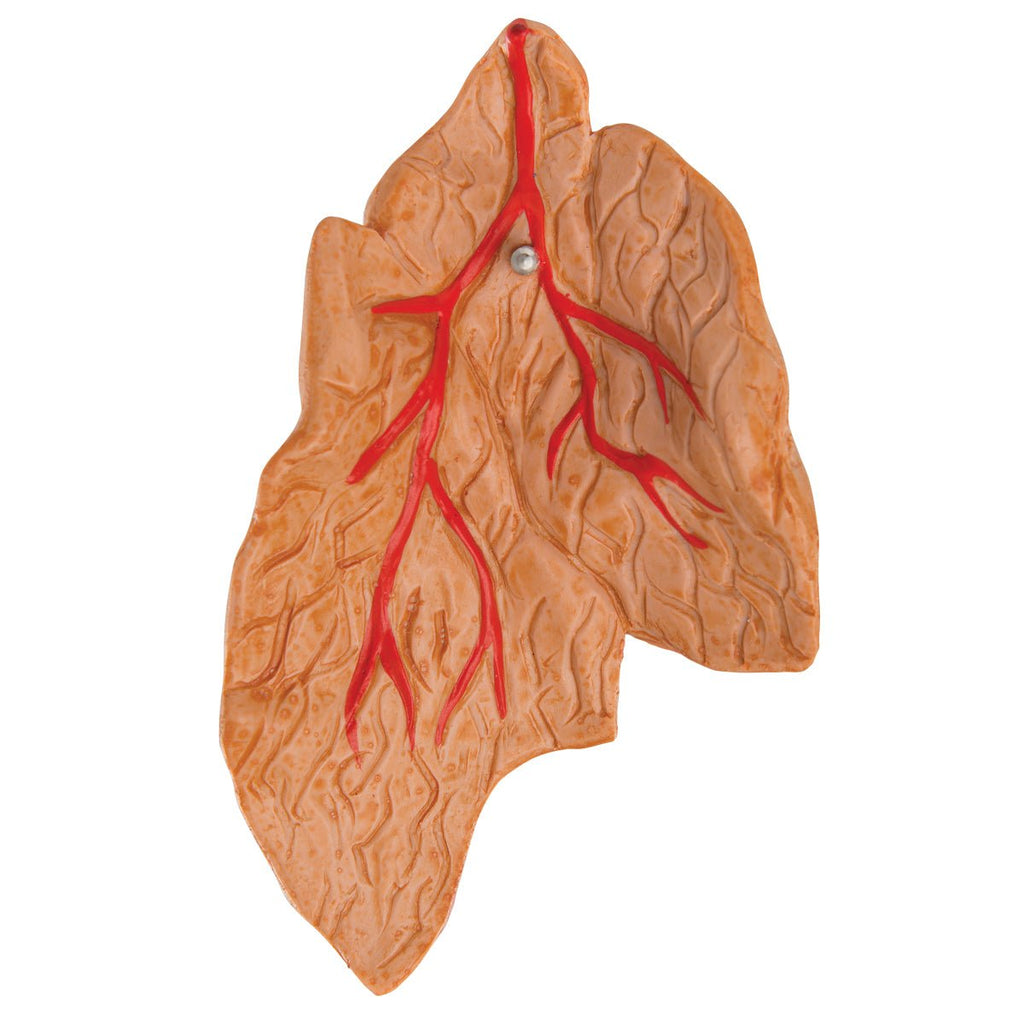 Formindsket hjerte m. thymus - eAnatomi