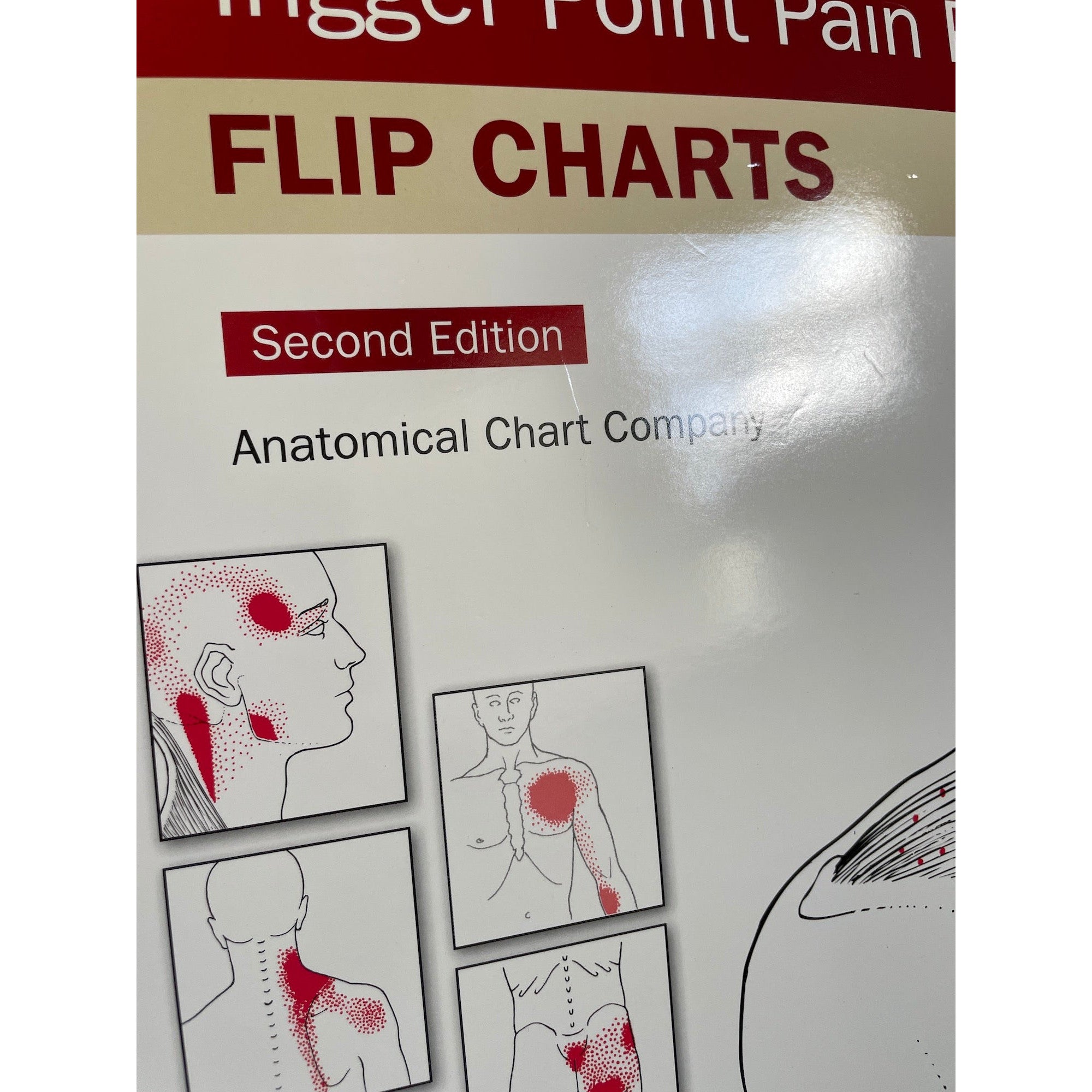 Flipover (bordmodel) om triggerpunkter på engelsk v 2.0 2. SORTERING