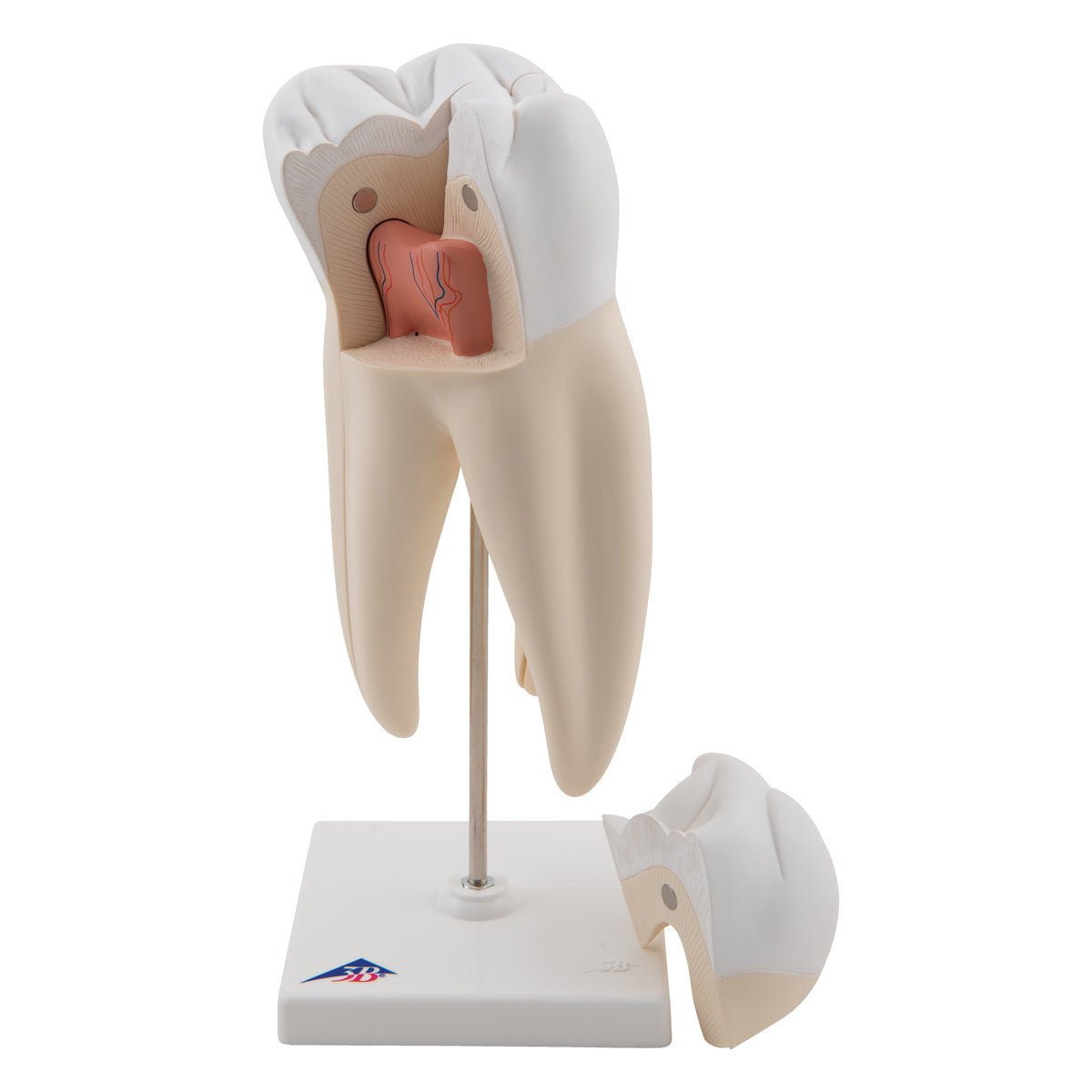 Tænder m. caries - eAnatomi
