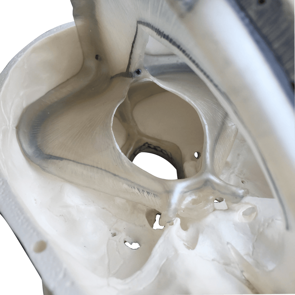 Kranie m. udsnit af dura mater, 2 dele - eAnatomi