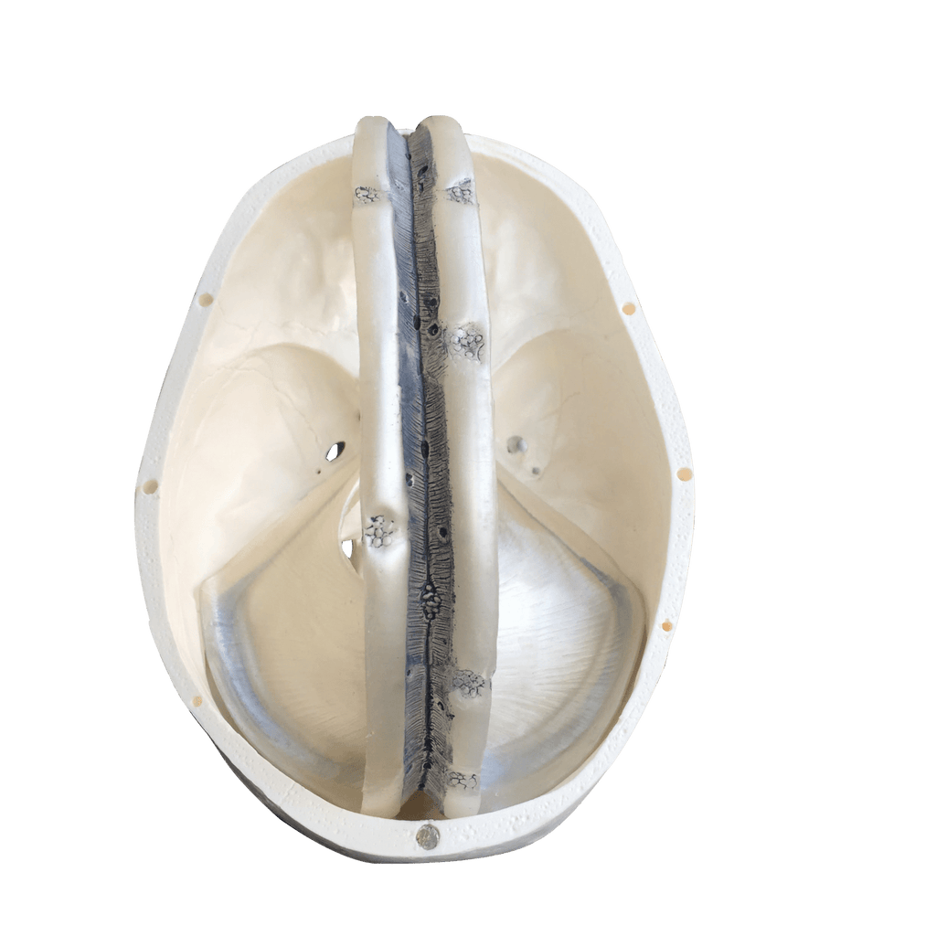 Kranie m. udsnit af dura mater, 2 dele - eAnatomi