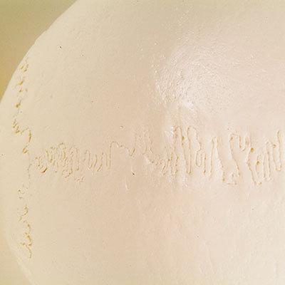 Skull with cervical vertebrae, 2 parts