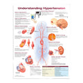 Lamineret plakat om for højt blodtryk på engelsk - eAnatomi