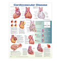 Poster about cardiovascular diseases in English 