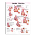 Plakat om hjertesygdomme på engelsk - eAnatomi
