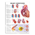 Lamineret plakat om hjertesygdomme på engelsk - eAnatomi