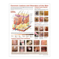 Lamineret plakat om huden og almindelige hudlidelser på engelsk II - eAnatomi