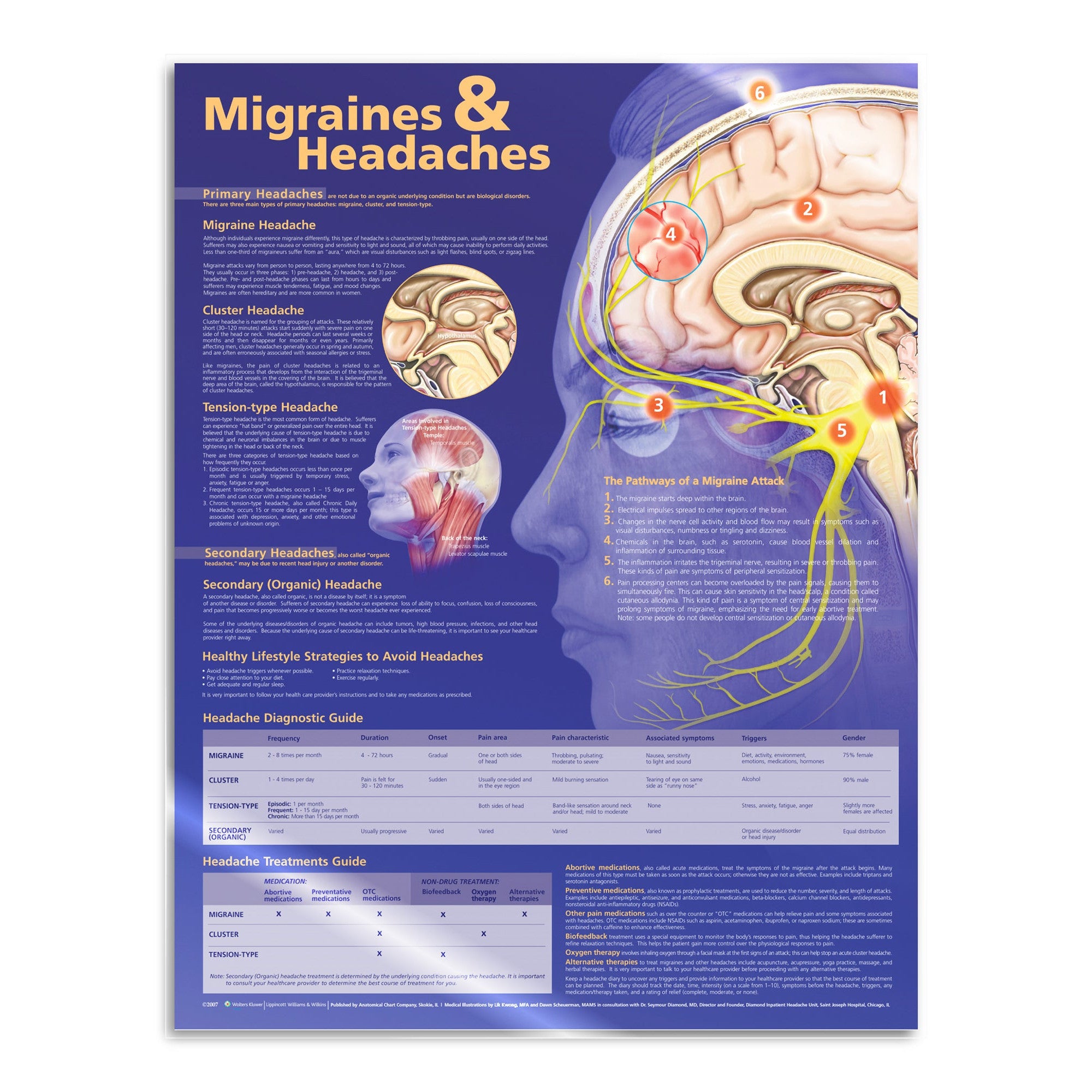 Laminated poster about migraines and headaches in English