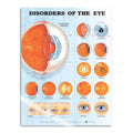 Lamineret plakat om øjensygdomme på engelsk - eAnatomi