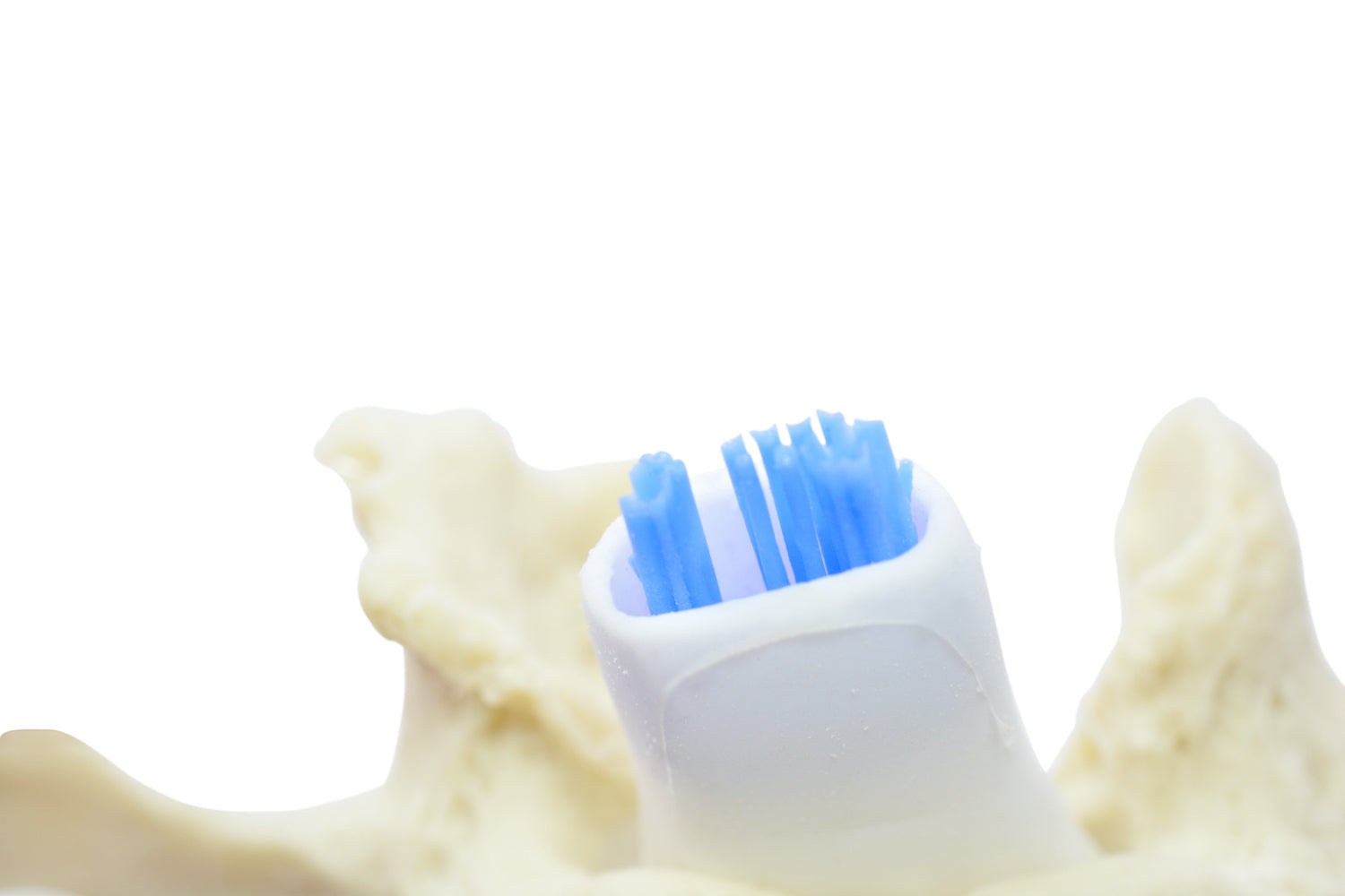 Lumbar vertebrae with spinal stenosis