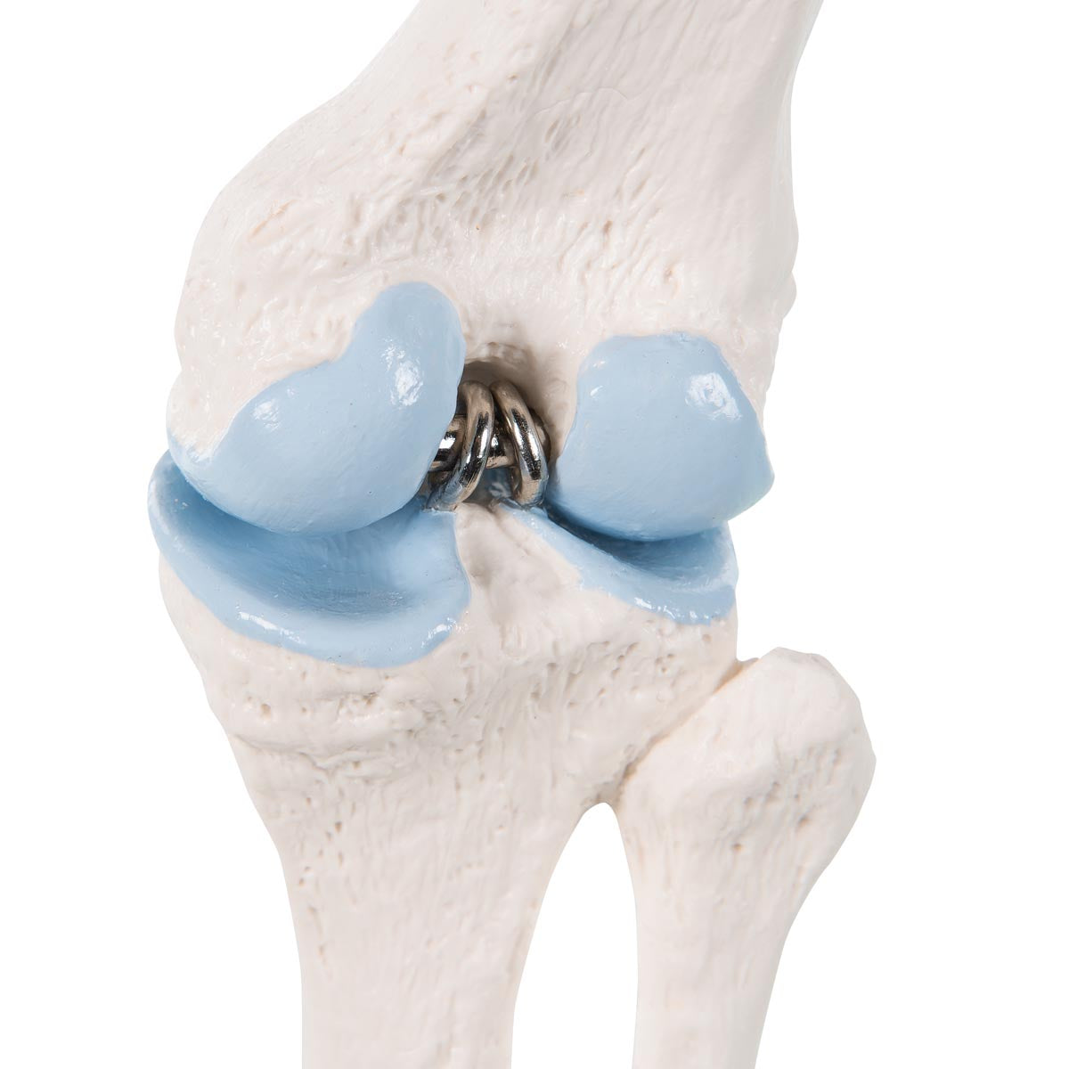 Reduced knee with sagittal section of the joint
