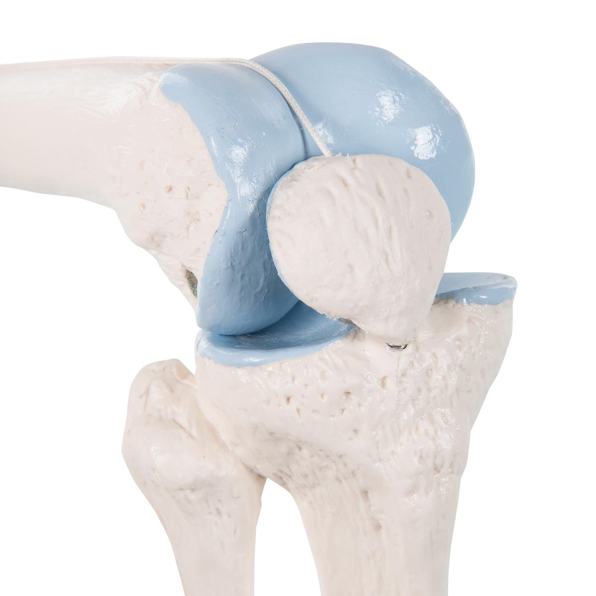 Reduced knee with sagittal section of the joint