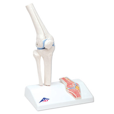 Reduced knee with sagittal section of the joint
