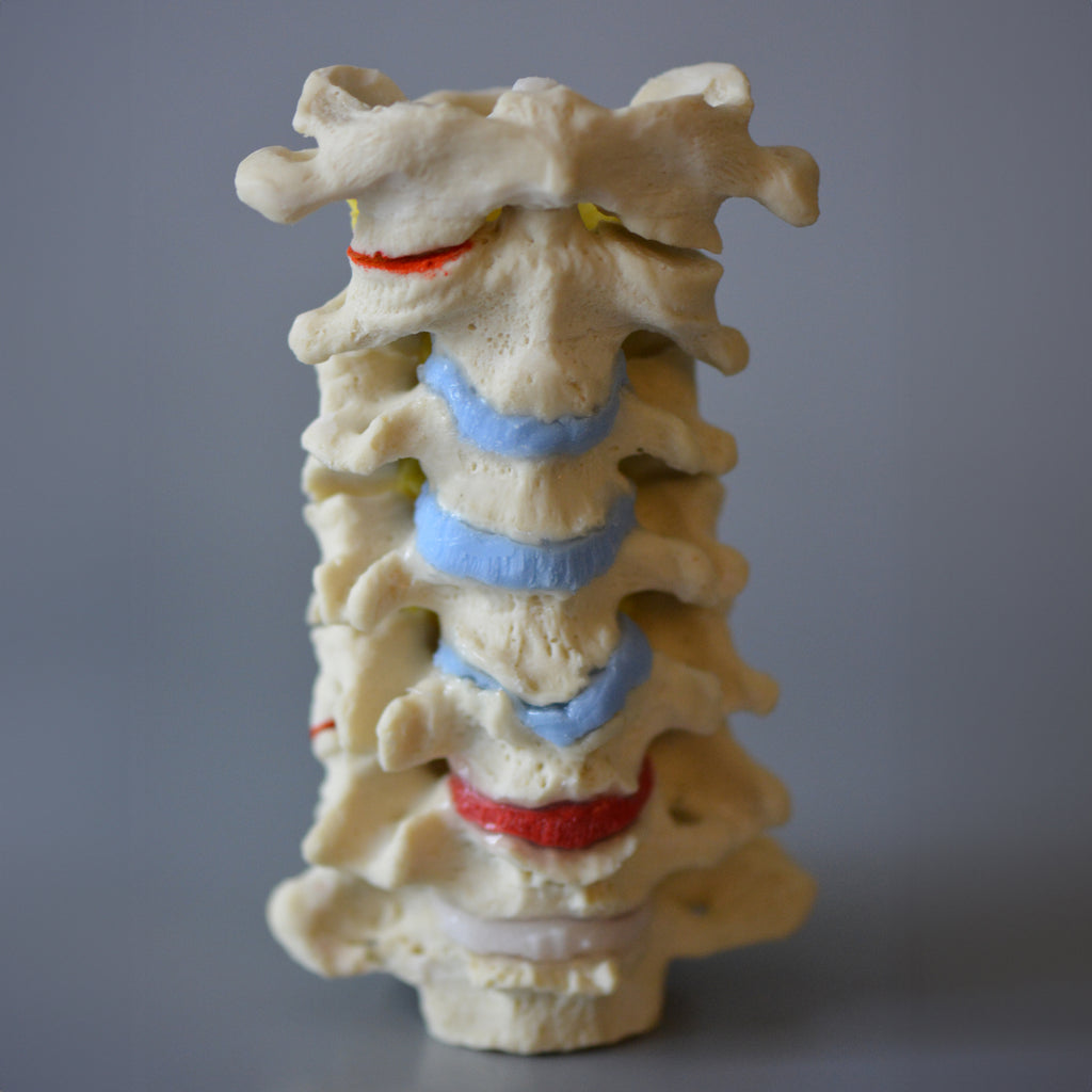 Cervical vertebrae m. degenerative changes