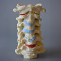 Cervical vertebrae m. degenerative changes