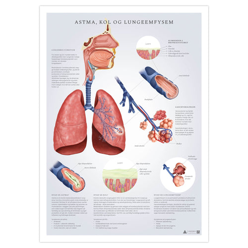 Plakat der forklarer astma, KOL og emfysem - eAnatomi