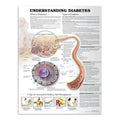 Plakat om de forskellige typer diabetes (sukkersyge) på engelsk - eAnatomi
