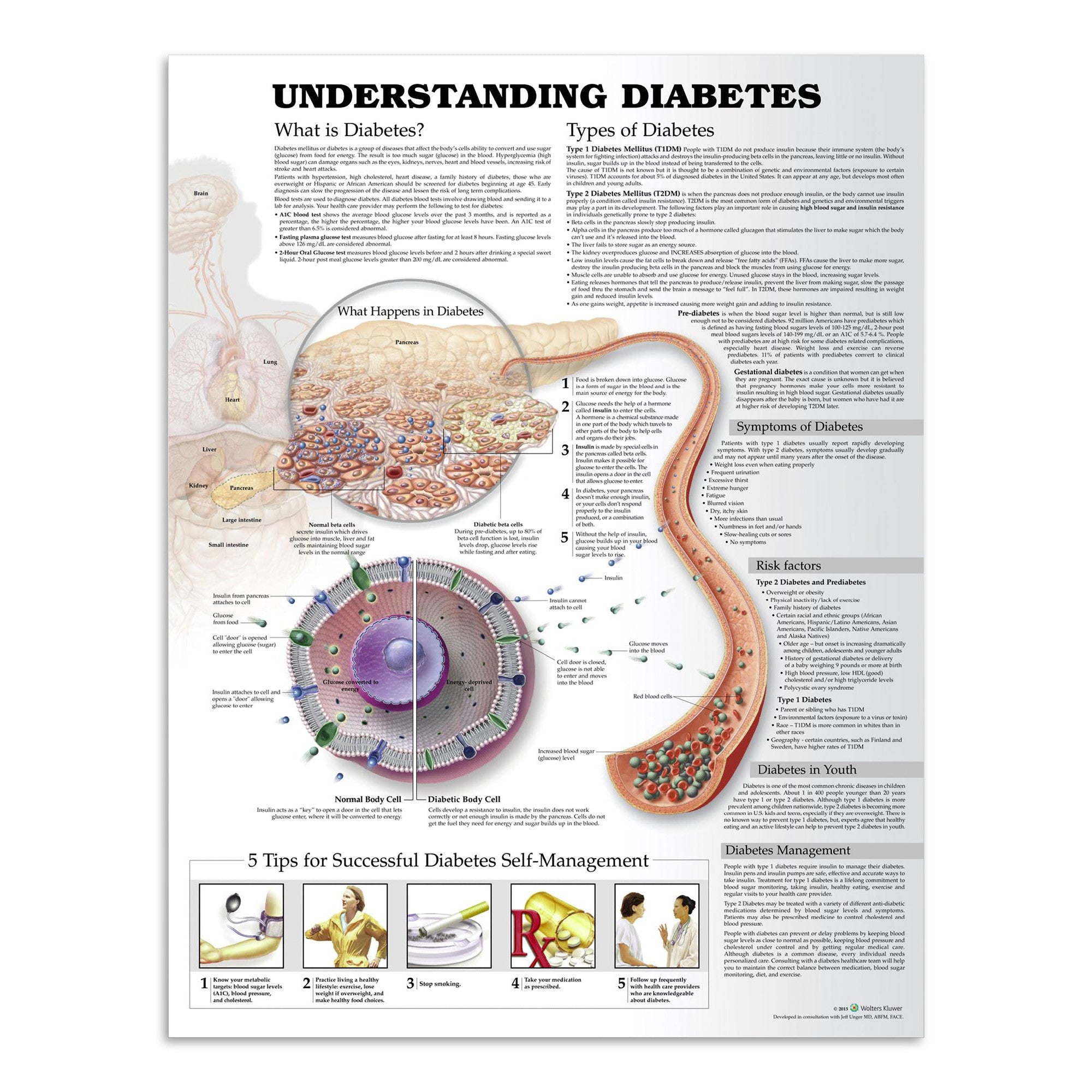 Plakat om de forskellige typer diabetes (sukkersyge) på engelsk - eAnatomi