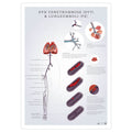 Plakat om dyb venetrombose og lungeemboli (DVT og PE) - eAnatomi