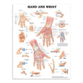 Plakat om hånden og håndleddets anatomi & skader på engelsk I - eAnatomi
