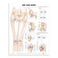 Plakat om hoften & knæet på engelsk - eAnatomi