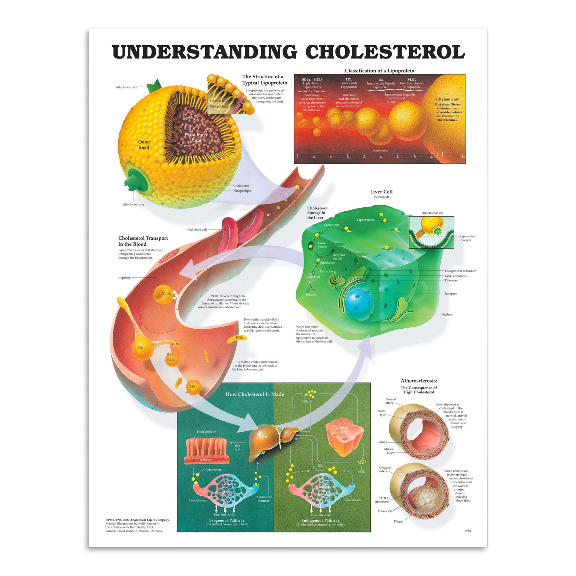Laminated poster about cholesterol in English