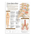 Plakat om lændesmerter på engelsk - eAnatomi