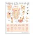 Plakat om lidelser i tænder & kæbe på engelsk - eAnatomi