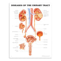 Plakat om de fleste sygdomme i nyren og urinvejene på engelsk - eAnatomi