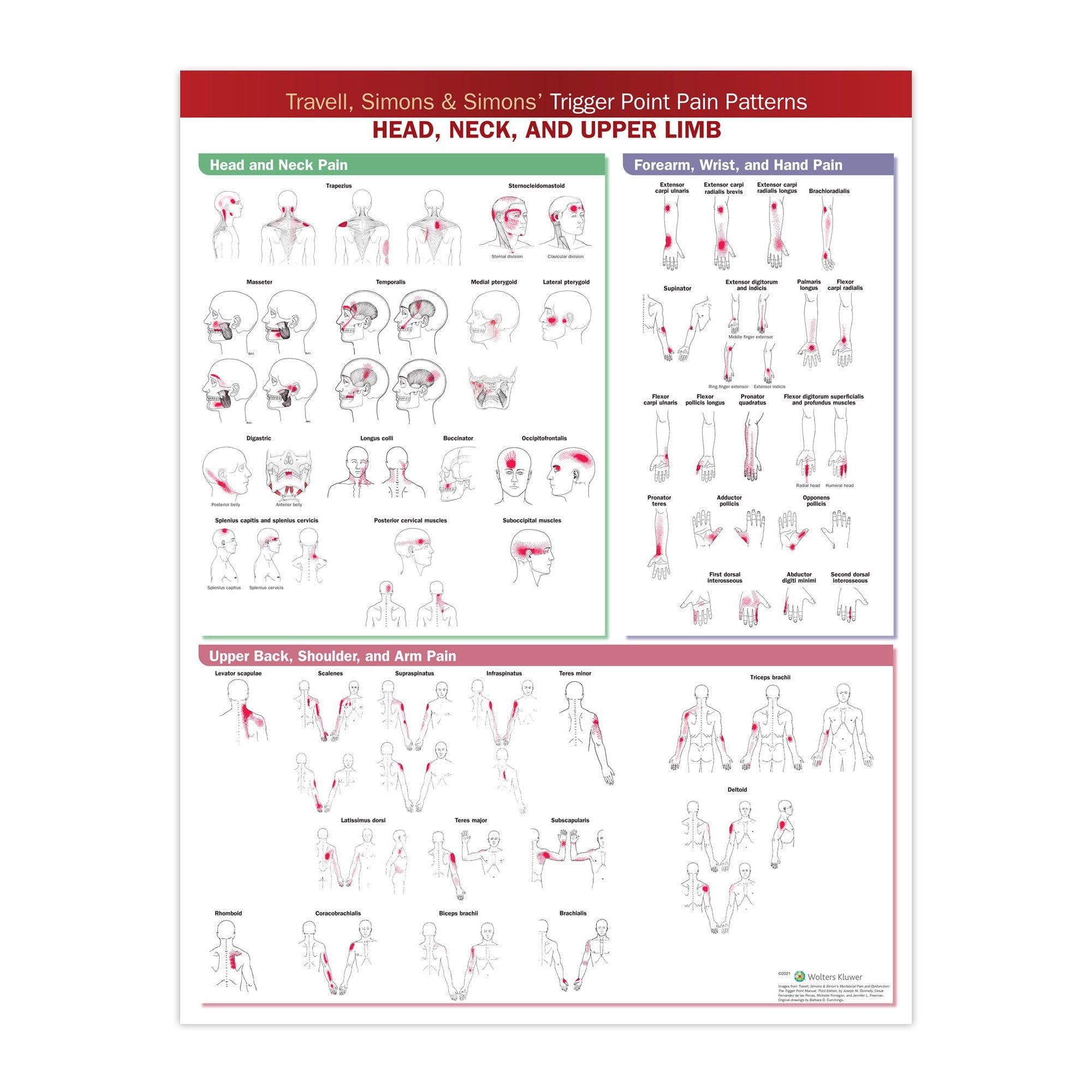 Plakat om "triggerpoint pain patterns" på engelsk 1