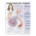 Plakat om type 1 diabetes (sukkersyge) på engelsk - eAnatomi