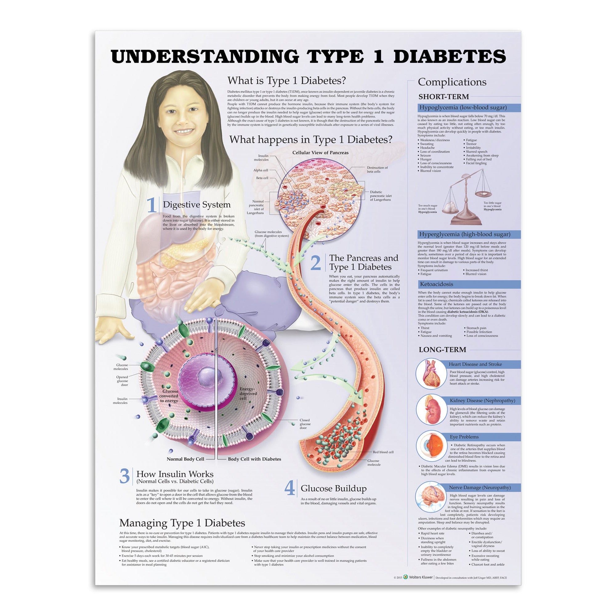 Plakat om type 1 diabetes (sukkersyge) på engelsk - eAnatomi