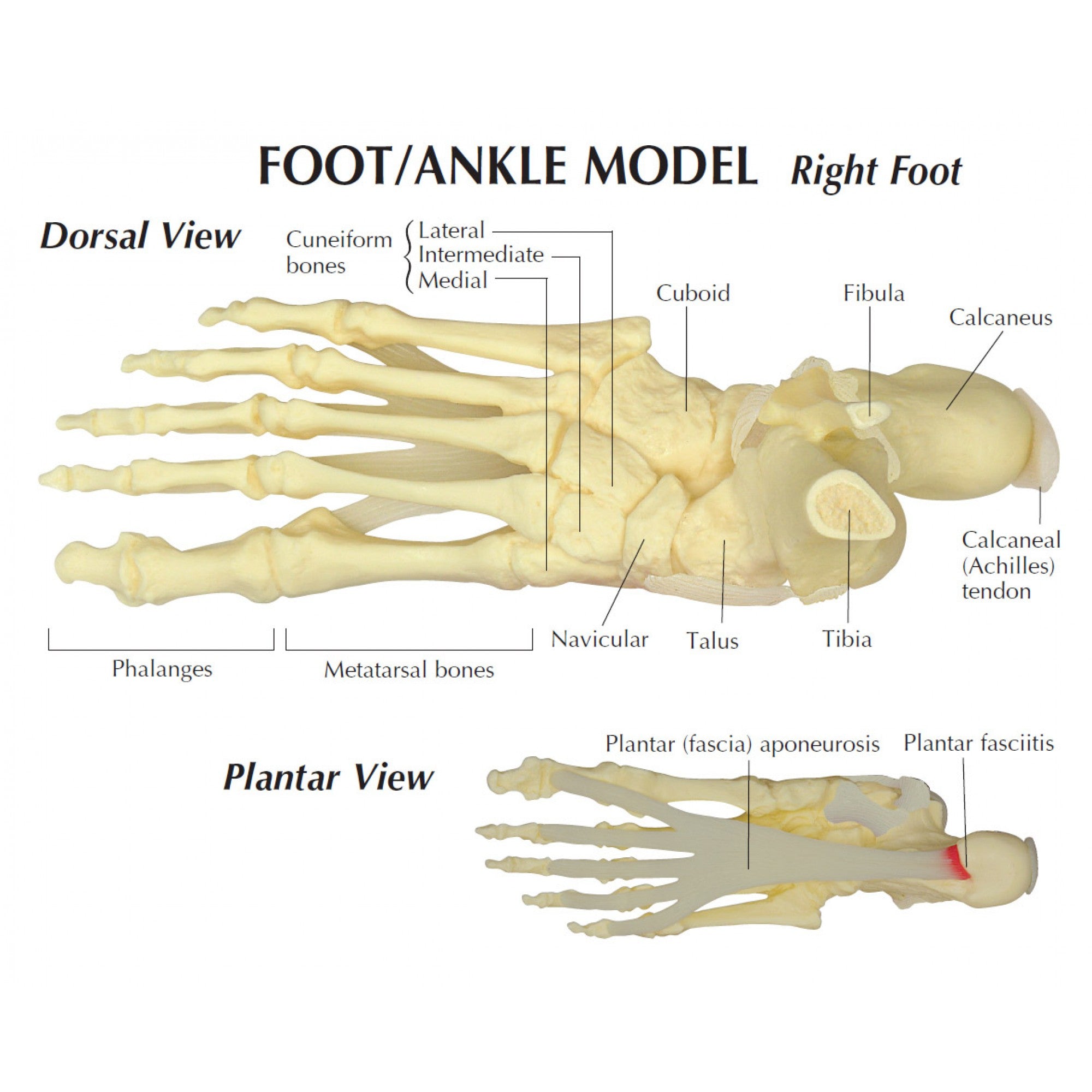 Fodskelet m. hælspore - eAnatomi