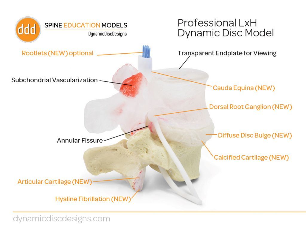 Transparent lumbar vertebra with herniated disc, vessels, lesions and cauda equina