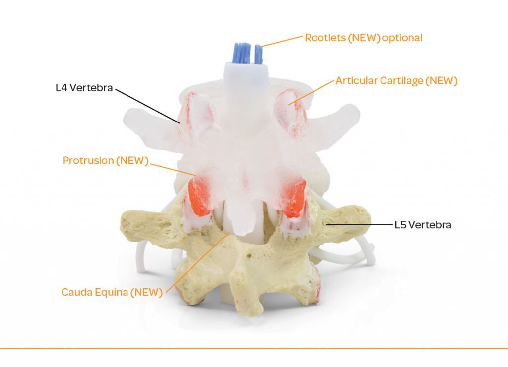 Transparent lumbar vertebra with herniated disc, vessels, lesions and cauda equina