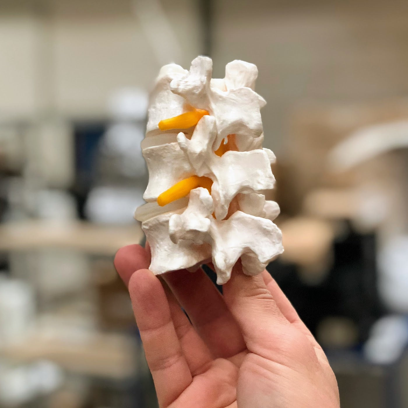 Særdeles fleksibel og simpel model af 3 lændehvirvler (L3-4-5)