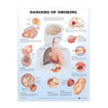 Plakat om skader ved rygning på engelsk - eAnatomi
