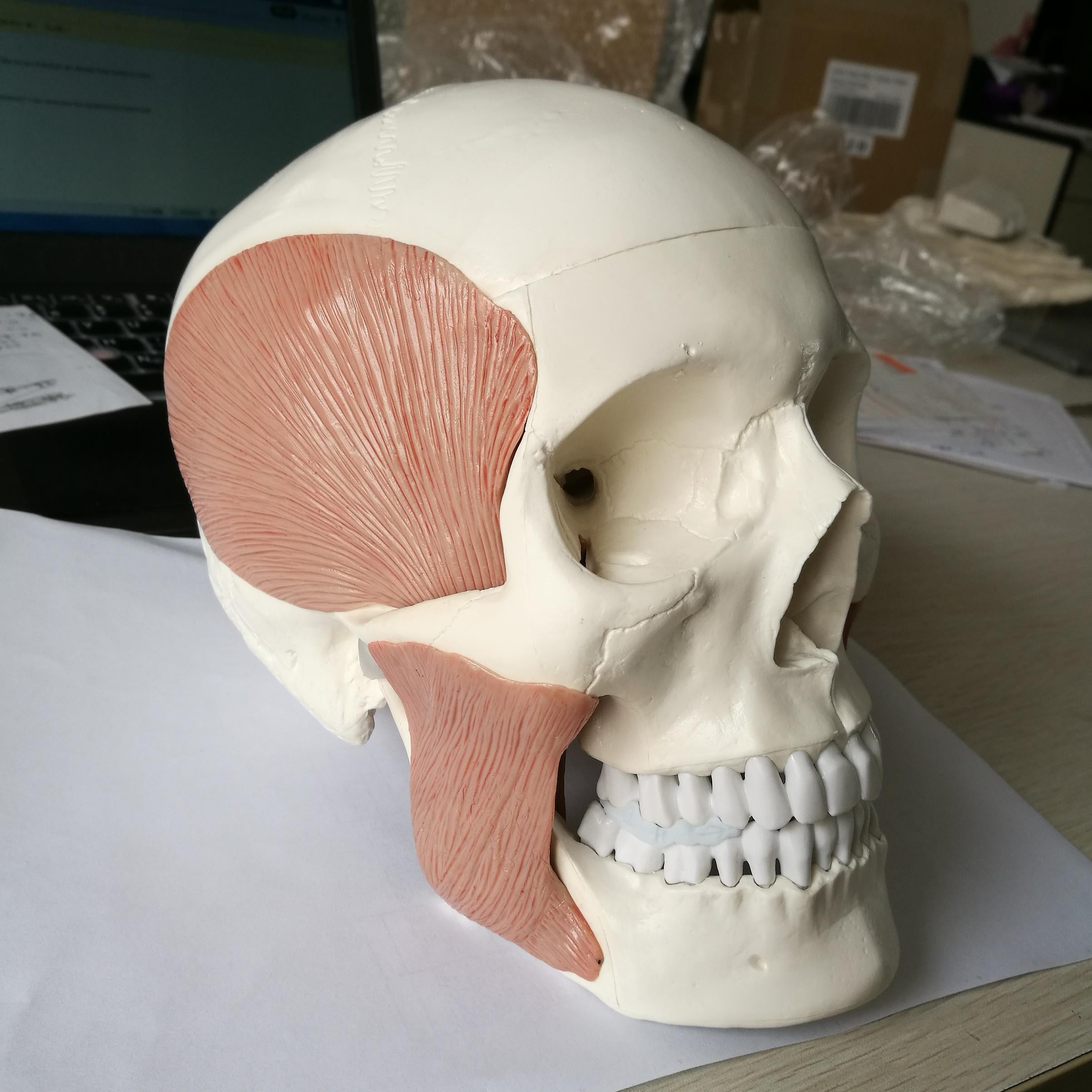 Skull with masticatory muscles, 10 parts